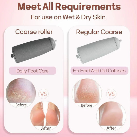 Foot callus remover in salon form